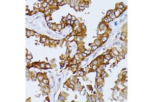 Immunohistochemistry (IHC) image for anti-Septin 4 (SEPT4) (AA 1-100) antibody (ABIN6147554)