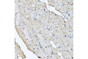 Immunohistochemistry of paraffin-embedded rat heart using USH1C antibody. (USH1C 抗体  (AA 1-100))
