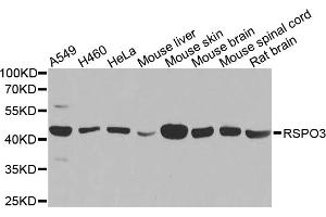 Western blot analysis of extracts of various cell lines, using RSPO3 antibody. (R-Spondin 3 抗体)