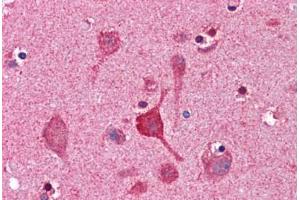 Human Brain, Cortex: Formalin-Fixed, Paraffin-Embedded (FFPE) (CCNDBP1 抗体  (AA 348-360))