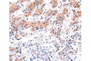 Immunohistochemistry (IHC) image for anti-C-Type Lectin Domain Family 4, Member D (CLEC4D) (AA 39-215) antibody (ABIN3016483)