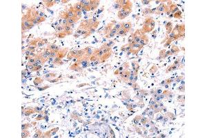 Immunohistochemistry (IHC) image for anti-C-Type Lectin Domain Family 4, Member D (CLEC4D) (AA 39-215) antibody (ABIN3016483) (CLEC4D 抗体  (AA 39-215))