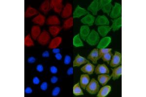 ABIN6257057 and ABIN6274550 staining Hela cells(45 min of heat-shock) by IF/ICC. (CHKB 抗体  (C-Term))