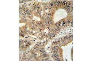 Immunohistochemistry (Paraffin-embedded Sections) (IHC (p)) image for anti-ATP-Binding Cassette, Sub-Family C (CFTR/MRP), Member 3 (ABCC3) (AA 899-925) antibody (ABIN654103)