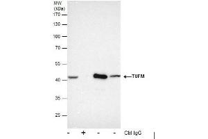 IP Image Immunoprecipitation of TUFM protein from HepG2 whole cell extracts using 5 μg of TUFM antibody , or TUFM antibody, Western blot analysis was performed using TUFM antibody, EasyBlot anti-Rabbit IgG  was used as a secondary reagent. (TUFM 抗体)