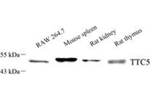 Western blot analysis of TTC5 (ABIN7075874),at dilution of 1: 1000,Lane 1: RAW 264. (TTC5 抗体)