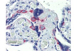 Anti-ZNF71 antibody IHC staining of human placenta. (ZNF71 抗体  (Middle Region))