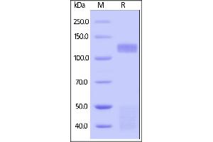 Insulin Receptor Protein (INSR) (AA 28-944) (His tag)