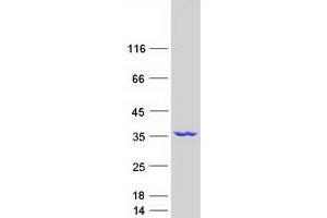 Western Blotting (WB) image for NmrA-Like Family Domain Containing 1 (NMRAL1) protein (Myc-DYKDDDDK Tag) (ABIN2727415)