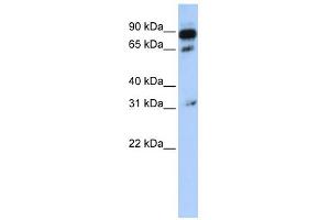 WB Suggested Anti-ABCD4 Antibody Titration:  0. (ABCD4 抗体  (N-Term))