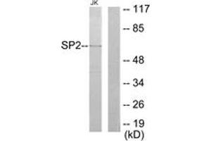 Western blot analysis of extracts from Jurkat cells, using SP2 Antibody. (Sp2 抗体  (AA 471-520))