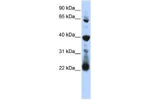 WB Suggested Anti-RPUSD3 Antibody Titration:  0. (RPUSD3 抗体  (Middle Region))
