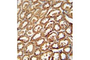 Immunohistochemistry (Paraffin-embedded Sections) (IHC (p)) image for anti-Degenerative Spermatocyte Homolog 2, Lipid Desaturase (DEGS2) (AA 268-298), (C-Term) antibody (ABIN951878)