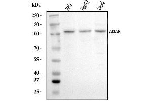 Western blot analysis of ADAR1/ADAR using anti-ADAR1/ADAR antibody (ABIN7598956). (ADAR 抗体  (AA 1-1152))