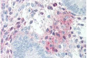 Human Uterus (formalin-fixed, paraffin-embedded) stained with SERPINF1 antibody ABIN337197 at 5 ug/ml followed by biotinylated anti-mouse IgG secondary antibody ABIN481714, alkaline phosphatase-streptavidin and chromogen.