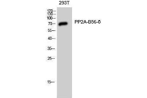 anti-PP2A-B56-delta (C-Term) antibody