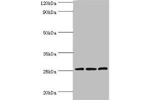 Western blot All lanes: Claudin-14 antibody at 4 μg/mL Lane 1: Rat liver tissue Lane 2: Mouse kidney tissue Lane 3: Hela whole cell lysate Secondary Goat polyclonal to rabbit IgG at 1/10000 dilution Predicted band size: 26 kDa Observed band size: 26 kDa (CLDN14 抗体  (AA 140-239))