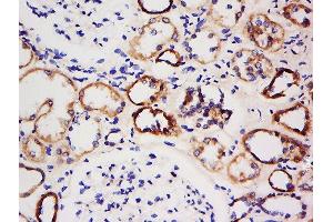 Immunohistochemistry (Paraffin-embedded Sections) (IHC (p)) image for anti-Protein Kinase, AMP-Activated, beta 1 Non-Catalytic Subunit (PRKAB1) (AA 2-100) antibody (ABIN2690018)