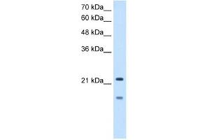 MMP7 antibody used at 2. (MMP7 抗体)