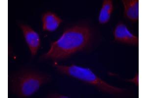 Immunofluorescence (IF) image for anti-Nitric Oxide Synthase 3 (Endothelial Cell) (NOS3) (pSer1177) antibody (ABIN1870485) (ENOS 抗体  (pSer1177))