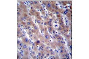 Immunohistochemistry analysis in Formalin Fixed, Paraffin Embedded Human liver tissue stained with FADS2 Antibody (N-term) followed by peroxidase conjugation of the secondary antibody and DAB staining. (FADS2 抗体  (N-Term))