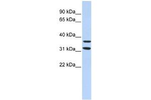 WB Suggested Anti-ZNF254 Antibody Titration:  0. (ZNF254 抗体  (Middle Region))