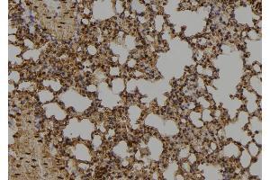 Immunohistochemistry (IHC) image for anti-Inhibitor of DNA Binding 1, Dominant Negative Helix-Loop-Helix Protein (ID1) (Internal Region) antibody (ABIN6262441)