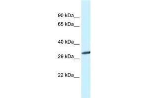 WB Suggested Anti-Gnmt Antibody   Titration: 1. (GNMT 抗体  (C-Term))