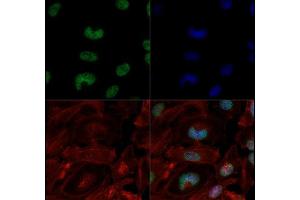 Fluorescence Microscopy (FM) image for anti-Histone 3 (H3) (H3K4me3), (H3K9ac) antibody (ABIN5706769)