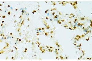 Immunohistochemistry of paraffin-embedded Rat lung using RCC1 Polyclonal Antibody at dilution of 1:100 (40x lens). (RCC1 抗体)