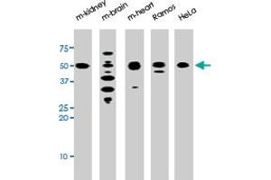 The park polyclonal antibody  is used in Western blot to detect park in, from left to right, mouse kidney, mouse brain, mouse heart, Ramos, and HeLa tissue lysates . (Parkin 抗体  (N-Term))