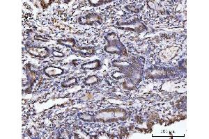 IHC analysis of UBA6 using anti-UBA6 antibody (ABIN7602559).