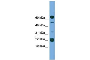 WB Suggested Anti-TMEM107 Antibody Titration:  0. (TMEM107 抗体  (N-Term))