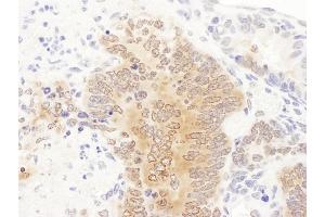 Immunohistochemistry (IHC) image for anti-Phosphoribosylglycinamide Formyltransferase (GART) (AA 200-250) antibody (ABIN7455020) (GART 抗体  (AA 200-250))