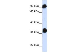 HSPA4 antibody used at 1 ug/ml to detect target protein. (HSPA4 抗体  (N-Term))