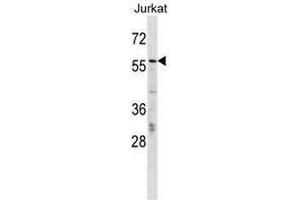CBFA2T2 Antibody (N-term) western blot analysis in Jurkat cell line lysates (35µg/lane). (CBFA2T2 抗体  (N-Term))