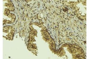ABIN6276536 at 1/100 staining Mouse colon tissue by IHC-P. (CTCF 抗体  (C-Term))