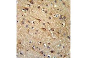 Immunohistochemistry (Paraffin-embedded Sections) (IHC (p)) image for anti-Retinal G Protein Coupled Receptor (RGR) (AA 262-291), (Middle Region) antibody (ABIN954529)