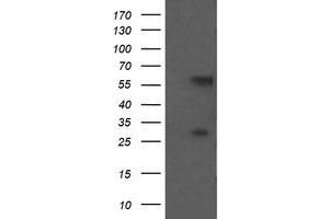 Image no. 1 for anti-Chaperonin Containing TCP1, Subunit 8 (Theta)-Like 2 (CCT8L2) antibody (ABIN1497483) (CCT8L2 抗体)