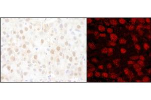 Immunohistochemistry (IHC) image for anti-Poly (ADP-Ribose) Polymerase 1 (PARP1) (AA 50-100) antibody (ABIN7455230) (PARP1 抗体  (AA 50-100))