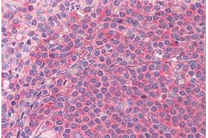 Human Spleen: Formalin-Fixed, Paraffin-Embedded (FFPE) (SH3GLB1 抗体  (AA 1-366))