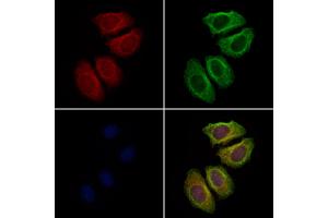 ABIN6262455 and ABIN6278876 staining Hela cells by IF/ICC.
