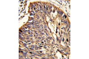 Immunohistochemistry (IHC) image for anti-Myeloid Differentiation Primary Response Gene (88) (MYD88) antibody (ABIN2915923) (MYD88 抗体)