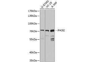 Western Blotting (WB) image for anti-Peptidyl Arginine Deiminase, Type II (PADI2) (AA 1-200) antibody (ABIN6145164)