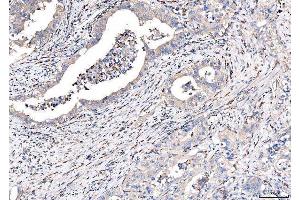 IHC analysis of CD163 using anti-CD163 antibody (ABIN5693082). (CD163 抗体  (AA 47-201))