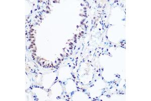 Immunohistochemistry of paraffin-embedded mouse lung using S Rabbit pAb (ABIN6128698, ABIN6147392, ABIN6147393 and ABIN6215703) at dilution of 1:100 (40x lens). (SART3 抗体  (AA 664-963))