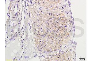 Formalin-fixed and paraffin embedded rat uterine myoma labeled with Rabbit Anti-ER-beta Polyclonal Antibody (ABIN725735) at 1:200 followed by conjugation to the secondary antibody and DAB staining. (TACR3 抗体  (AA 151-250))