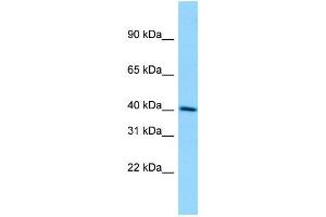 WB Suggested Anti-DMKN Antibody Titration: 1.