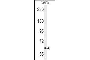 Western blot analysis in WiDr cell line lysates (35ug/lane). (PIK3R5 抗体  (C-Term))