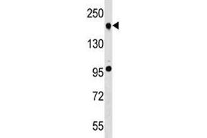 TET2 antibody western blot analysis in A549 lysate. (TET2 抗体  (AA 528-554))